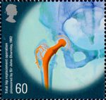 Medical Breakthroughs 60p Stamp (2010) Total hip replacement operation pioneered by Sir John Charnley 1962